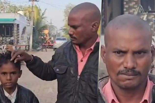 Hair Loss Strikes Three Villages in Maharashtra