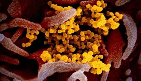 Human Metapneumovirus (HMPV) Emerges in China